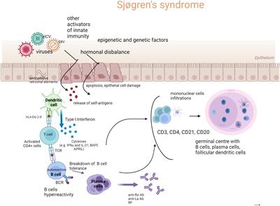 Immunoglobulin G4 in primary Sjögren’s syndrome and IgG4-related disease - connections and dissimilarities